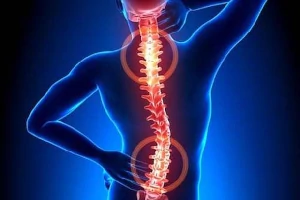 Image of person with chronic back pain