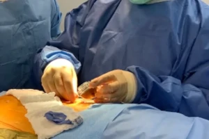 Picture of doctor performing an interventional pain management procedure