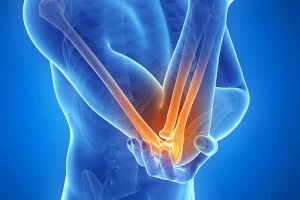 Image of person with elbow pain