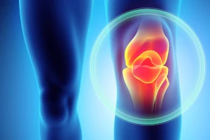 Image of person with knee pain